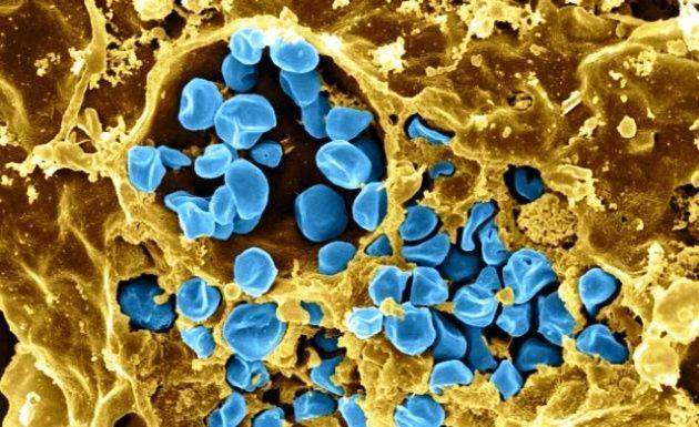 Tularemia prek 43 raste në Vushtrri dhe 4 raste në Skënderaj