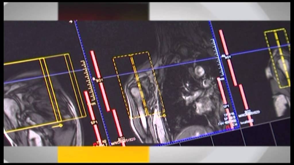 Radiologjia ruan në depo 25 mijë filma me afat të skaduar