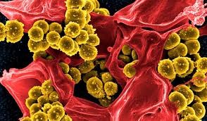 Shkencëtarët të tronditur nga përhapja e bakteries rezistente ndaj antibiotikëve 