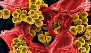 Shkencëtarët të tronditur nga përhapja e bakteries rezistente ndaj antibiotikëve