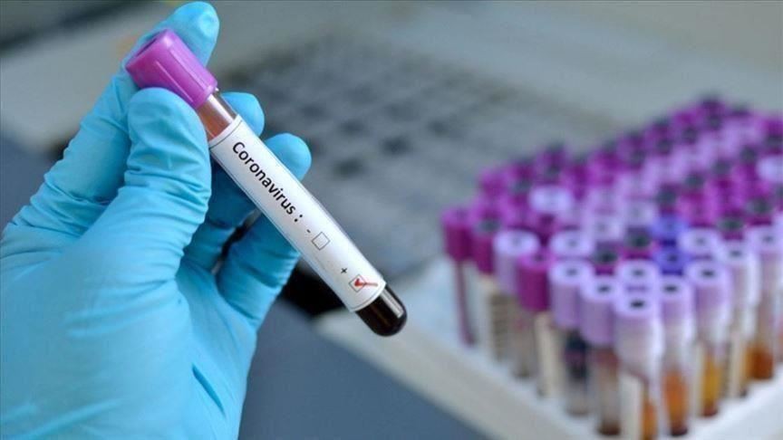 Sot në Kosovë regjistrohen 17 vdekje dhe 294 raste me koronavirus