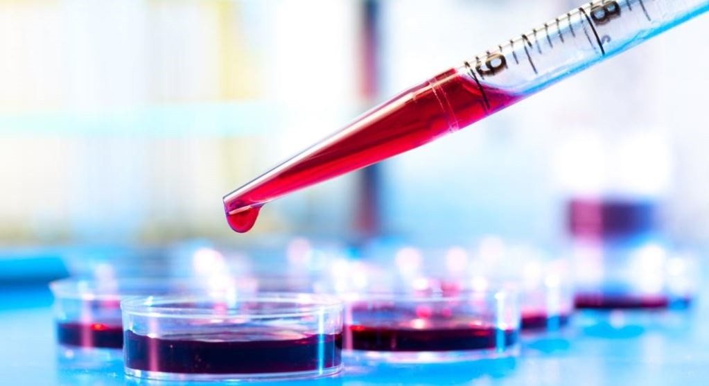 Shkencëtarët australianë zbulojnë testin e gjakut që vëren kanceret e lëkurës 