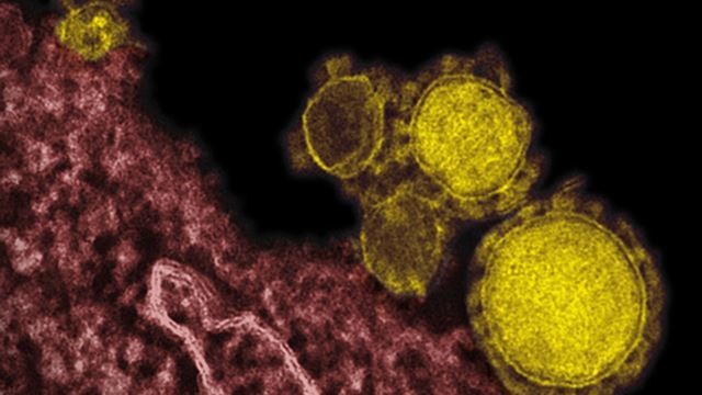 Konfirmohet rasti i parë në SHBA i virusit MERS